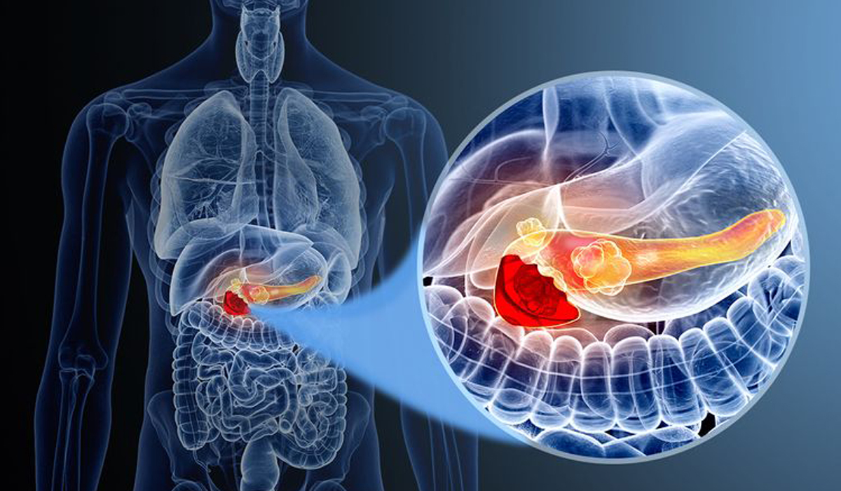 Breakthrough mRNA vaccine promises a cure for killer pancreatic cancer